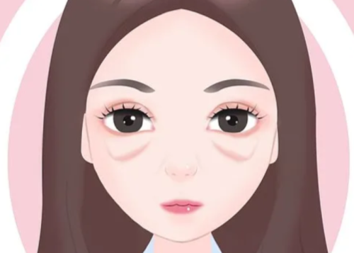 贺洁眼袋外翻修复案例,经典案例拆解,适合哪些人?效果能维持多久?