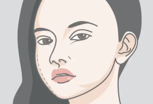 修复馒化脸要多少钱？馒化脸修复常用方案与项目组合价格参考