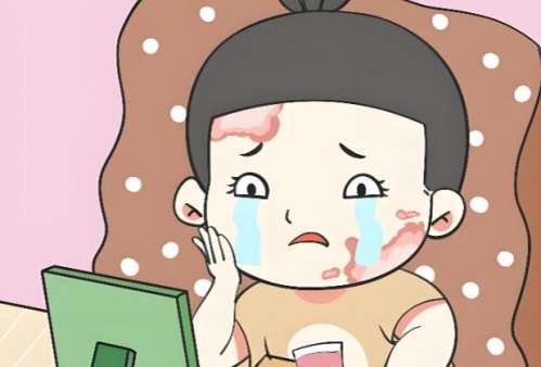 温州疤痕疙瘩修复医生排名top10(收费明细价目)